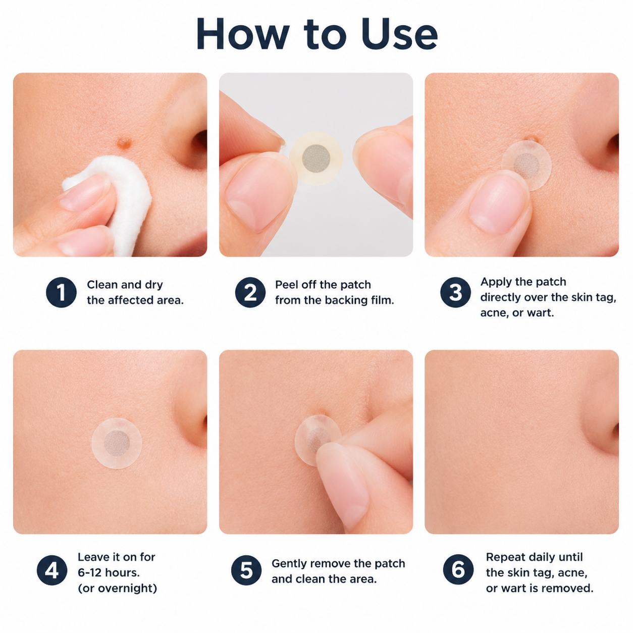 ✨Muwix®2-in-1 Microneedle & Hydrocolloid Patch🍀| Removes Raised Moles, Acne, Flat Warts & Skin Tags | Helps Improve Wrinkles, Scars & Blemishes | Invisible Patches for Face & Body