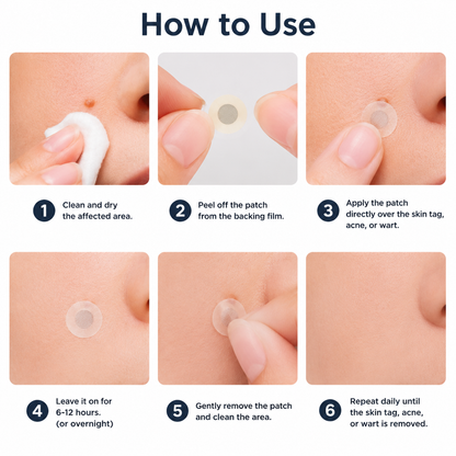 ✨Muwix®2-in-1 Microneedle & Hydrocolloid Patch🍀| Removes Raised Moles, Acne, Flat Warts & Skin Tags | Helps Improve Wrinkles, Scars & Blemishes | Invisible Patches for Face & Body