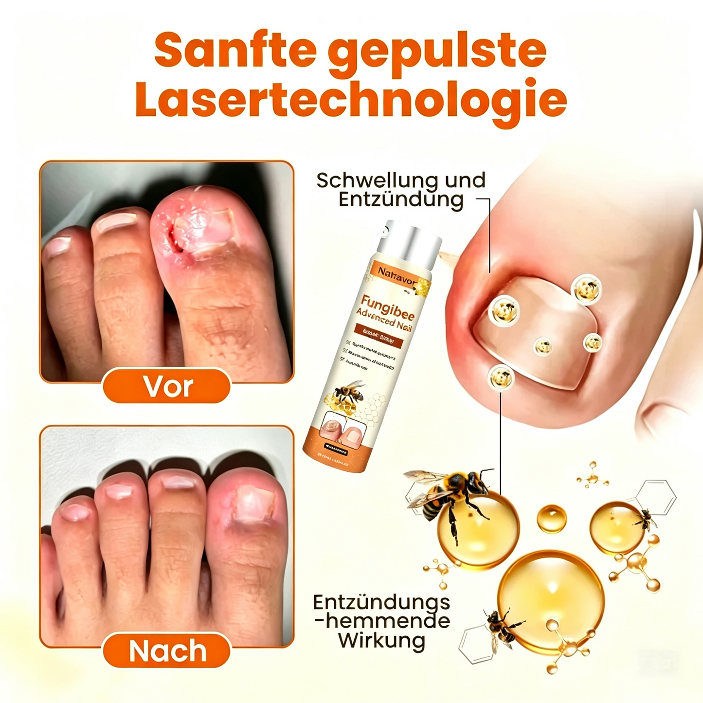 Natravor® Hochwertiges Spray zur Nagelpflege