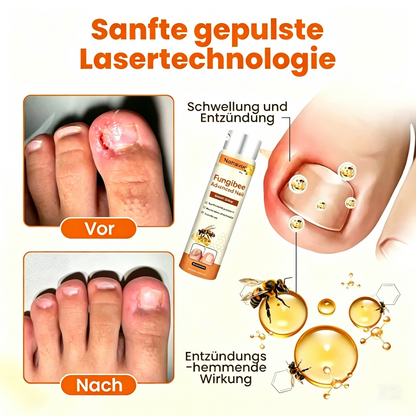 Natravor® Hochwertiges Spray zur Nagelpflege