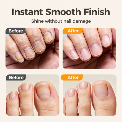 ✂️ Hot Sale This Week 💅 2-in-1 Smart Electric Nail Clipper & Polisher 🌟