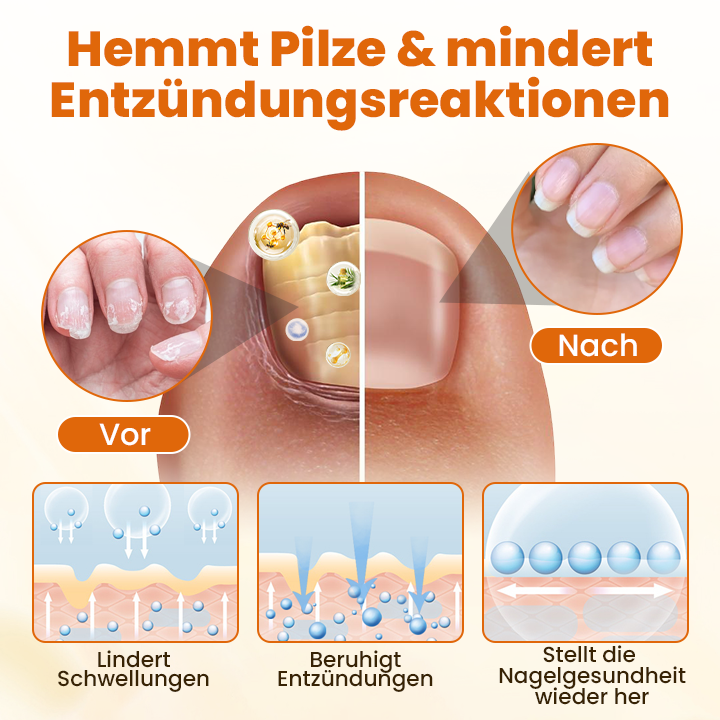 Timilk® Hochwertiges Spray zur Nagelpflege